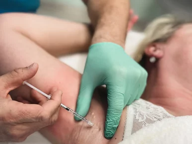 odstránenie potenia hyperhidroza